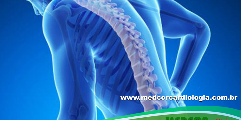 OSTEOPOROSE