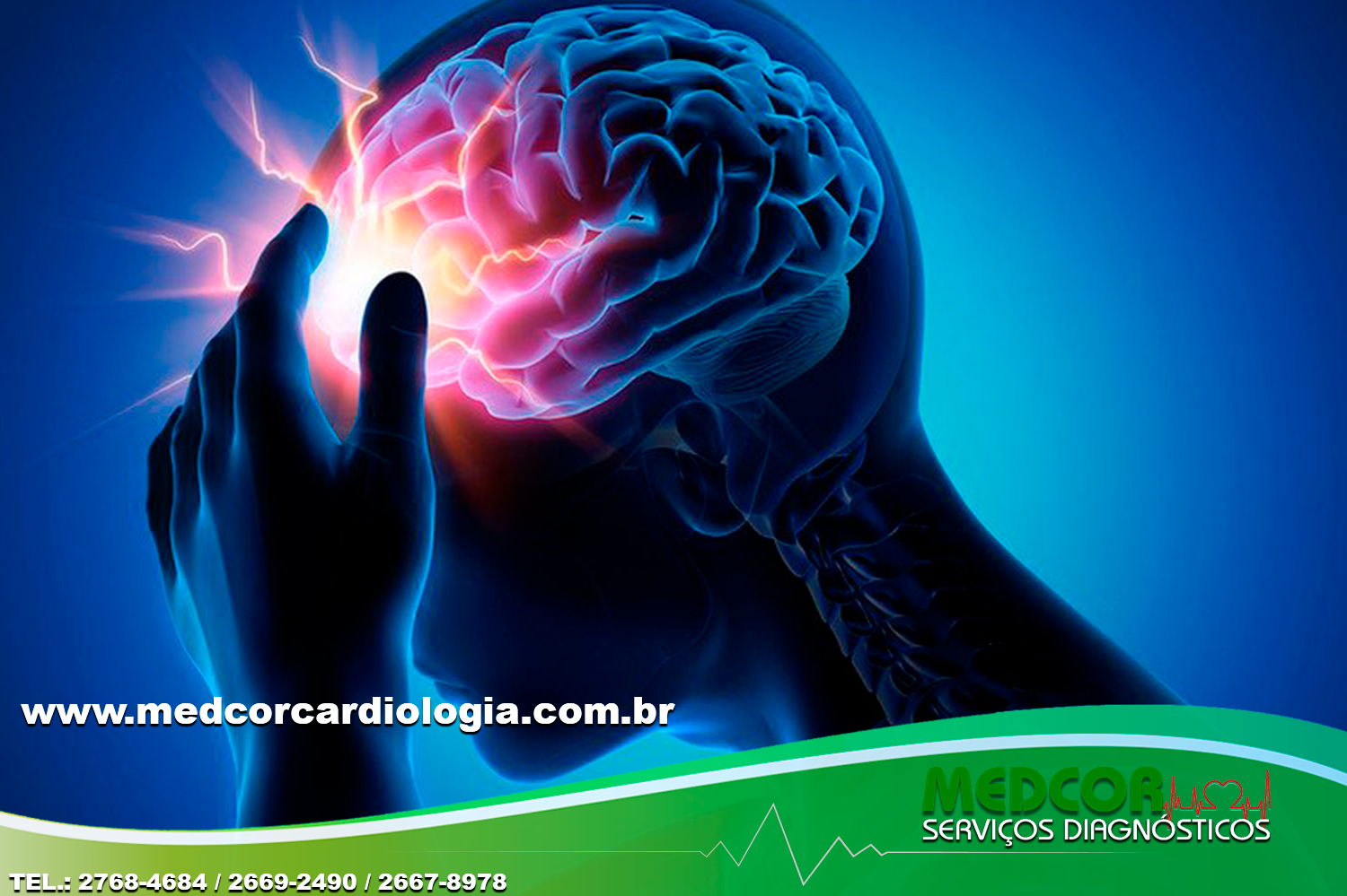 O que é o Acidente Vascular Cerebral (AVC)? O que é o Acidente Vascular Cerebral (AVC)?