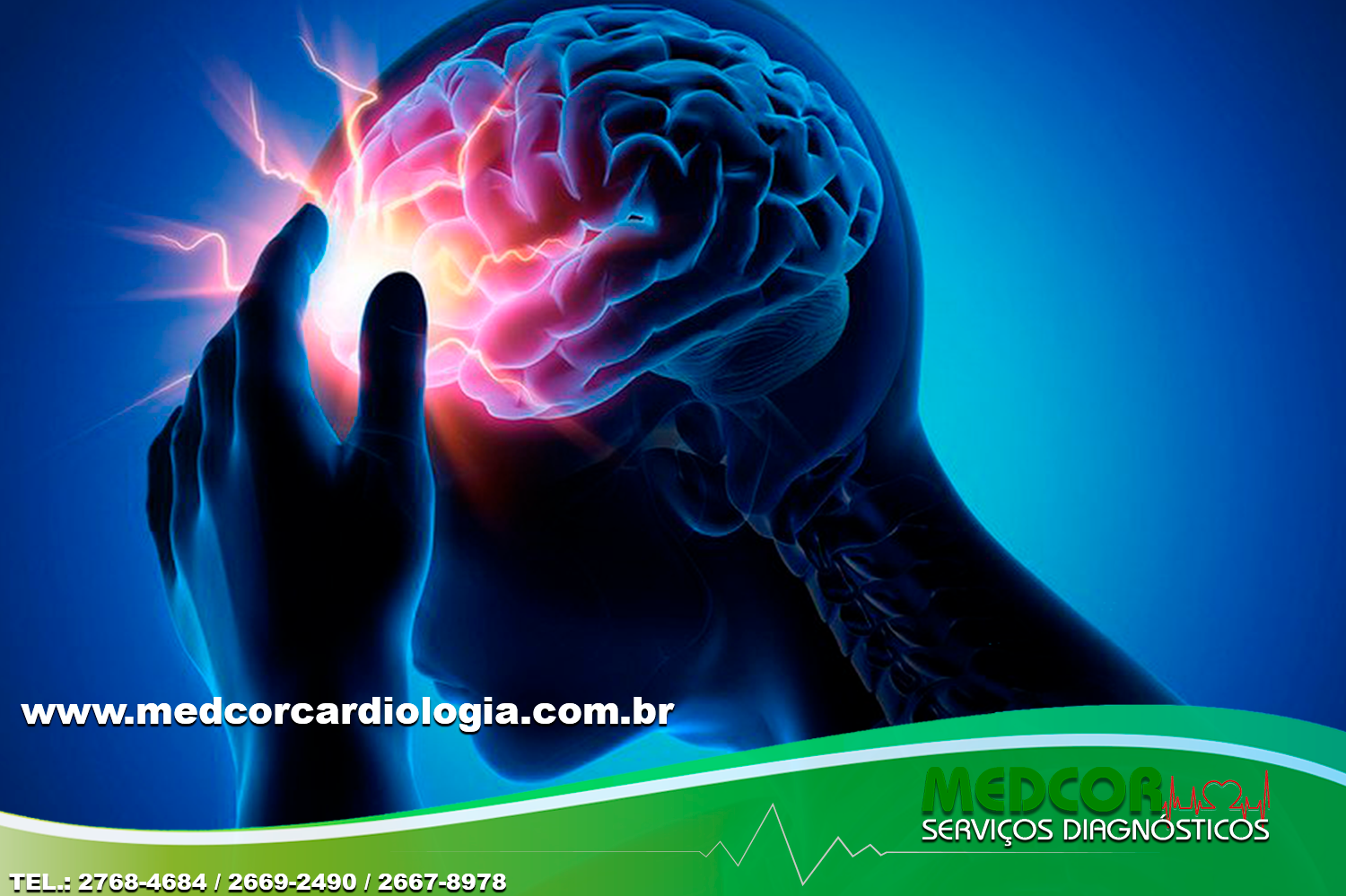 O que é o Acidente Vascular Cerebral (AVC)?