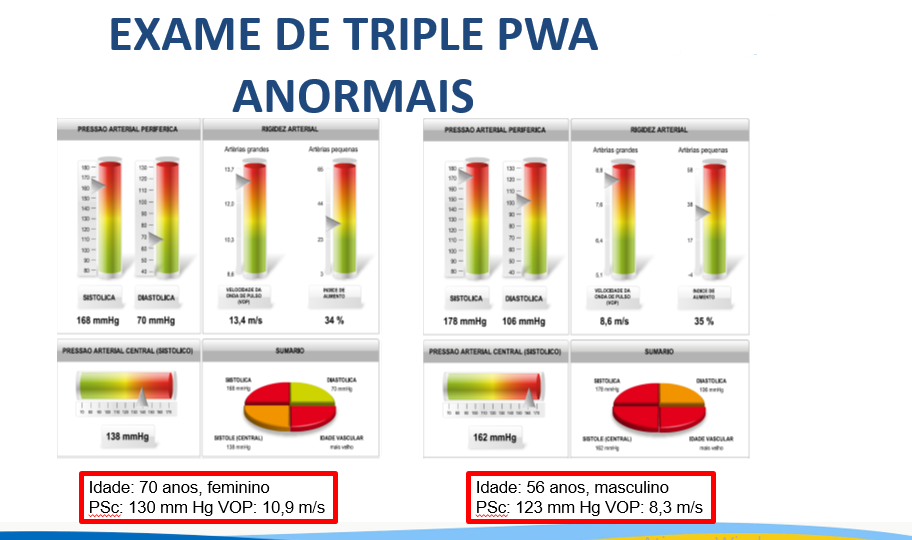 Artigo sobre PRESSÃO CENTRAL, VOP e Alx publicado no jornal O ESTETO DA AMNI Artigo sobre PRESSÃO CENTRAL, VOP e Alx publicado no jornal O ESTETO DA AMNI