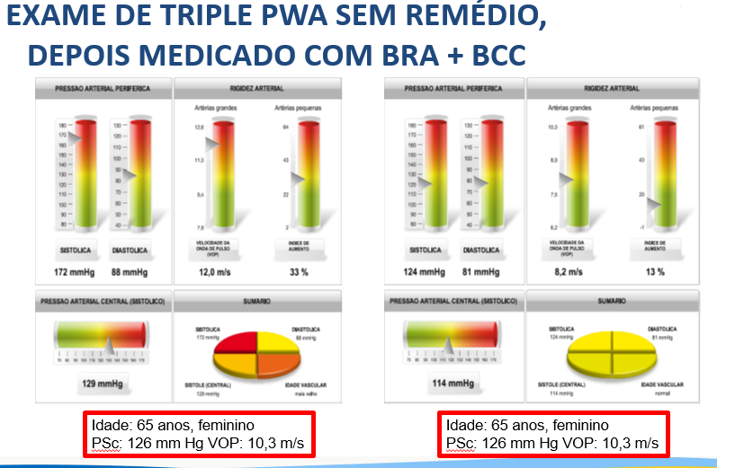 Artigo sobre PRESSÃO CENTRAL, VOP e Alx publicado no jornal O ESTETO DA AMNI Artigo sobre PRESSÃO CENTRAL, VOP e Alx publicado no jornal O ESTETO DA AMNI