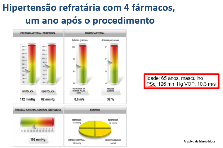 Artigo sobre PRESSÃO CENTRAL, VOP e Alx publicado no jornal O ESTETO DA AMNI Artigo sobre PRESSÃO CENTRAL, VOP e Alx publicado no jornal O ESTETO DA AMNI