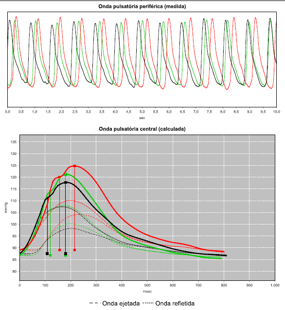 Artigo sobre PRESSÃO CENTRAL, VOP e Alx publicado no jornal O ESTETO DA AMNI Artigo sobre PRESSÃO CENTRAL, VOP e Alx publicado no jornal O ESTETO DA AMNI